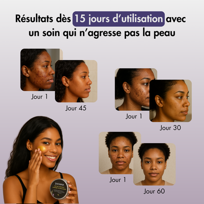 Baume Visage Anti-Tâches